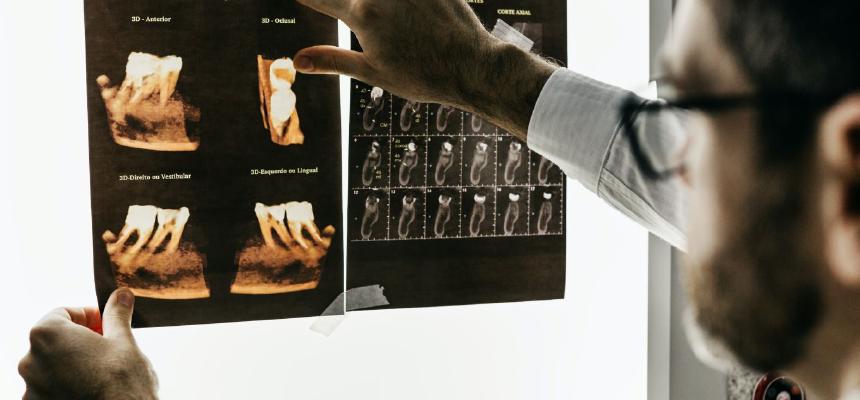 Foto van een tandarts die een röntgenfoto van een gebit bekijkt. 